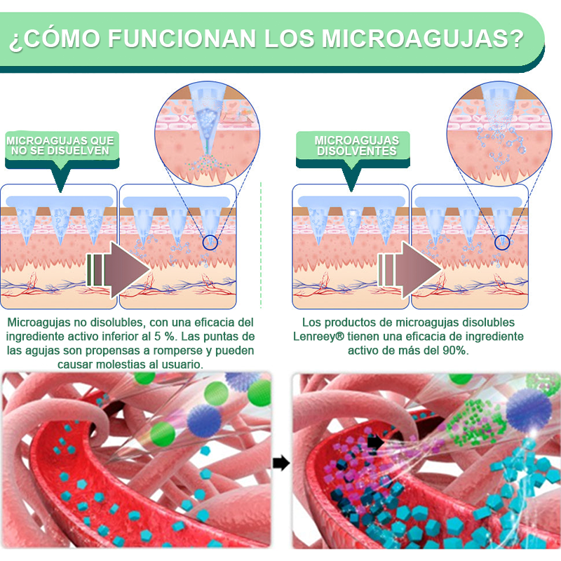 【Último día de promoción: 60% DE DESCUENTO🏅】Lenreey® Parche NANO de microagujas NIDDK-Tirzepatide para Adelgazar y Salud(Sin dolor, liberación 24/7 | Pierde 9 kg RÁPIDO | Reducción del 90% en azúcar | )🍀